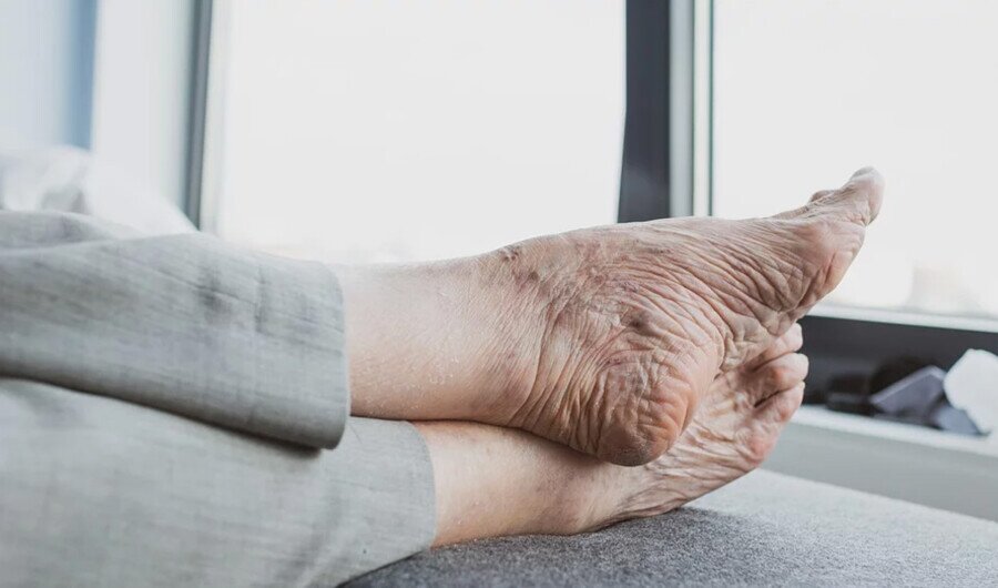 podologia geriatrica podologia geriatrica Dr. Angée su mejor alternativa