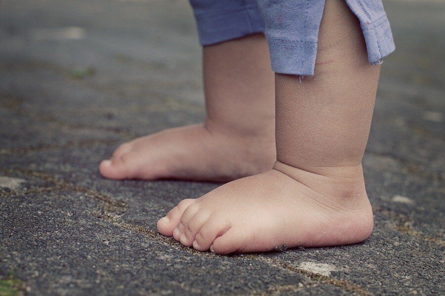 podologia pediatrica podologia pediatrica Dr. Angee su mejor alternativa.